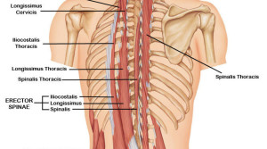 Erector-spinae-Iliocostalis-Thoracis